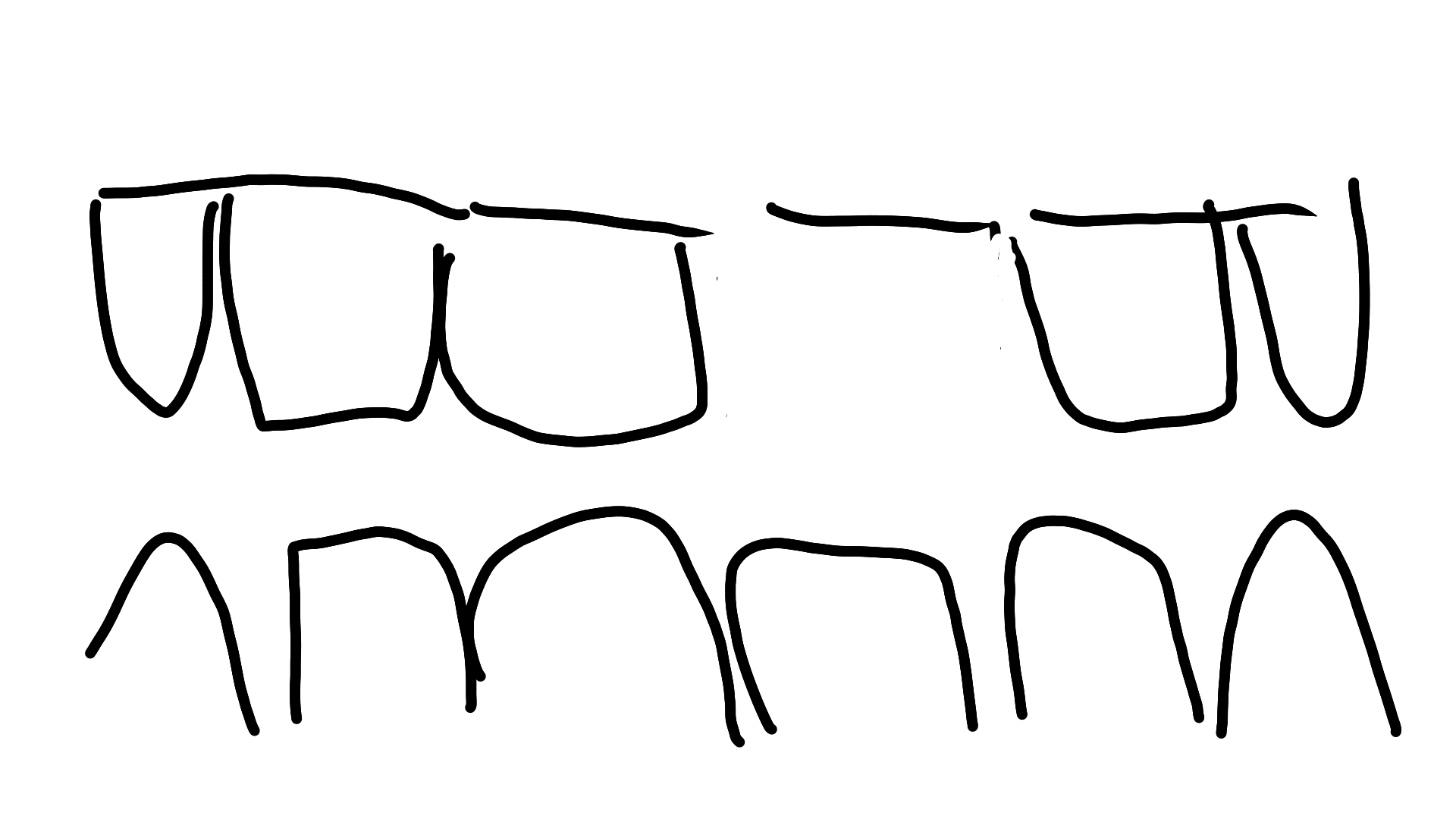 【前歯欠損レポ】前歯は見た目だけじゃない。思いのほか発音に影響あって困惑するの巻